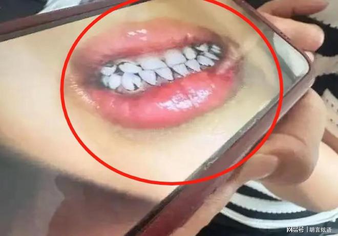 毒应该不是故意投毒而是不知添加剂内含铅尊龙凯时新版APP甘肃天水幼儿园铅中